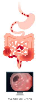 Amgen illus_Plan de travail