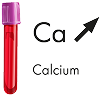 L'hypercalcémie